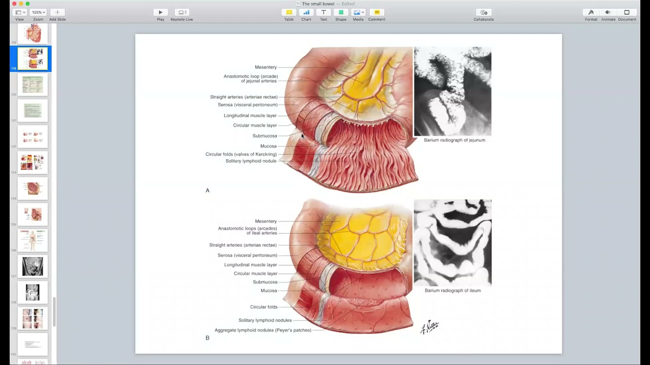 Small Bowel: Part 1 - General Surgery Course (4th + 6th Stages)