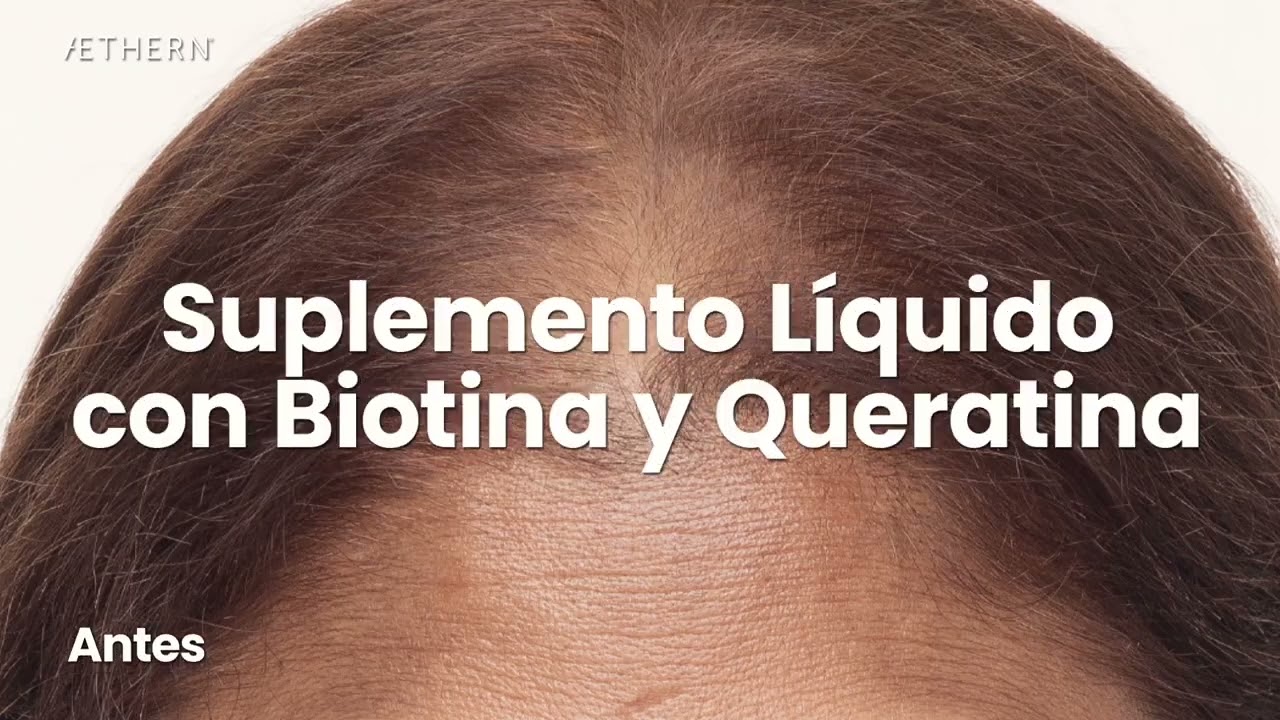 [ESP] Ultimate Hair Booster Before-After