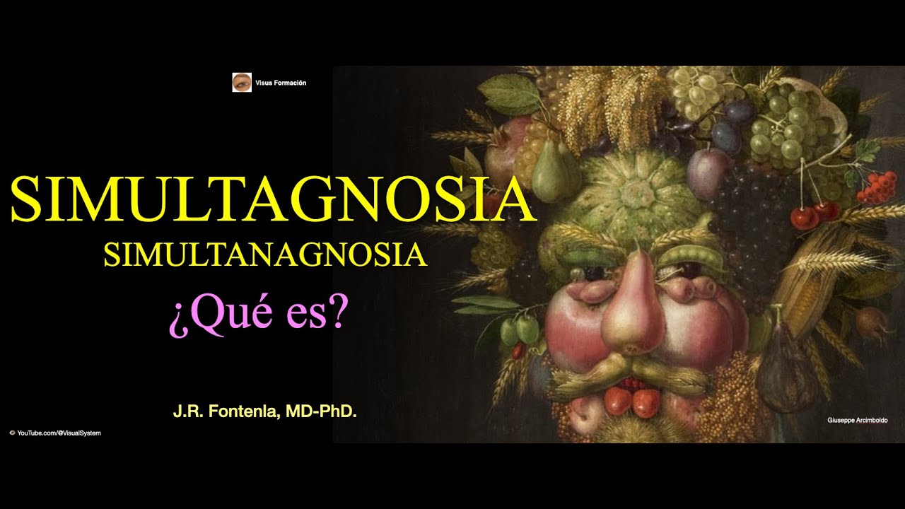 Simultagnosia. Agnosia Visual.