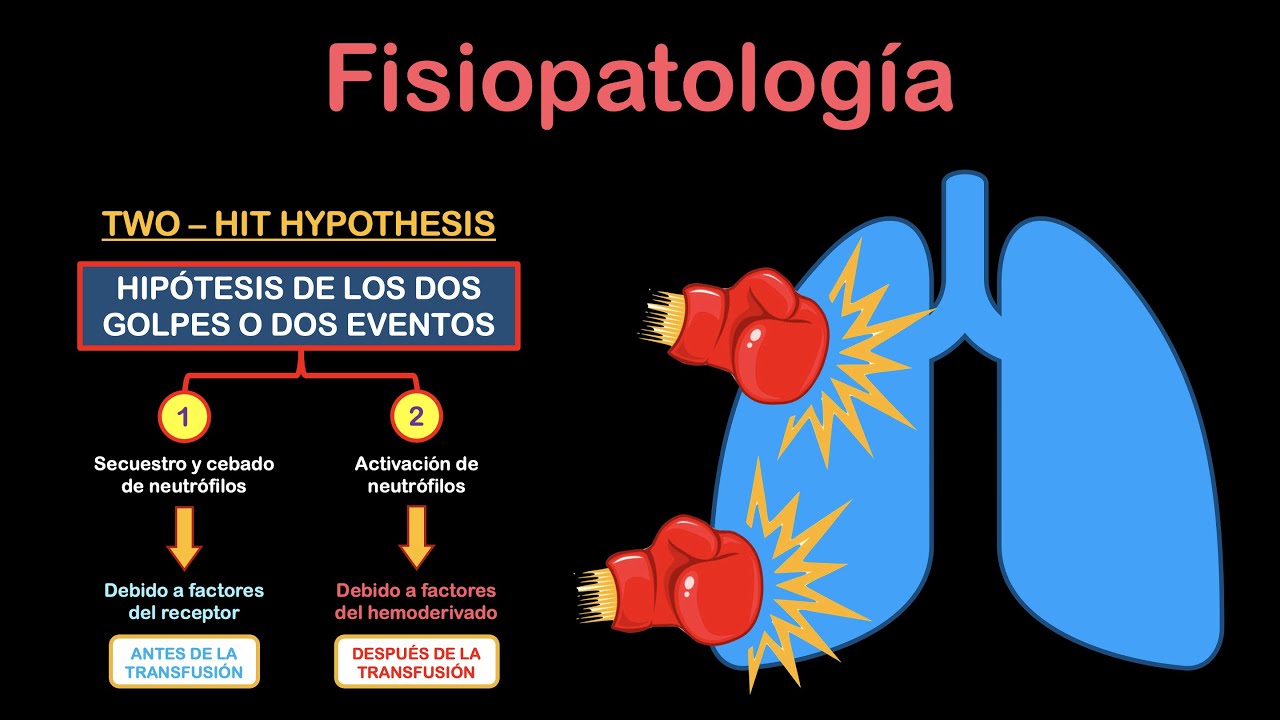 TRALI - Lesión pulmonar aguda relacionada con transfusión | Dr. Baelish
