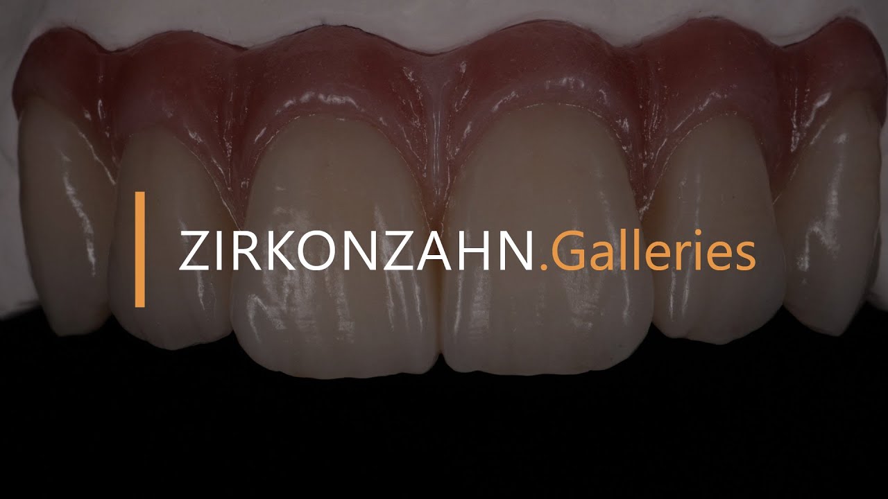Individual characterisation with ICE Ceramics | Zirkonzahn.Galleries