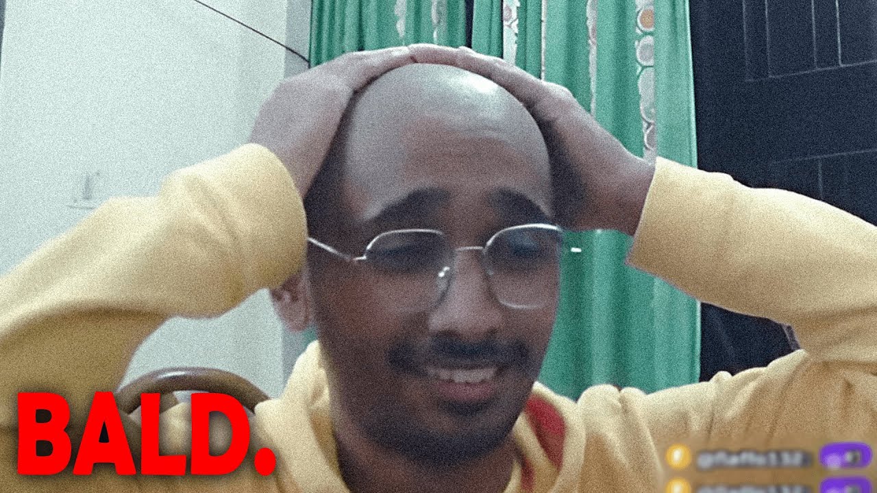 I am BALD.
