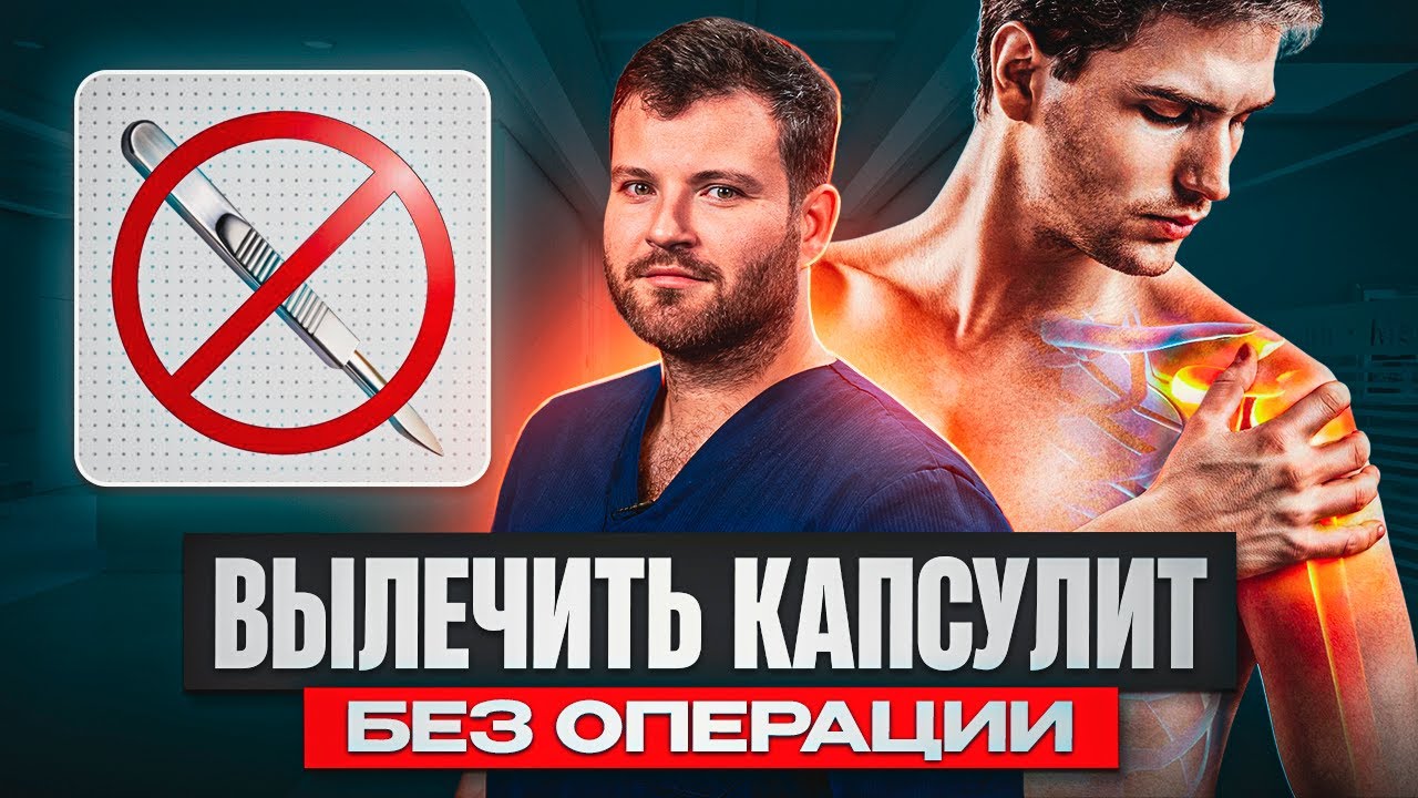 ЛЕЧИМ КАПСУЛИТ ПЛЕЧА: что можно и нельзя делать для быстрого восстановления