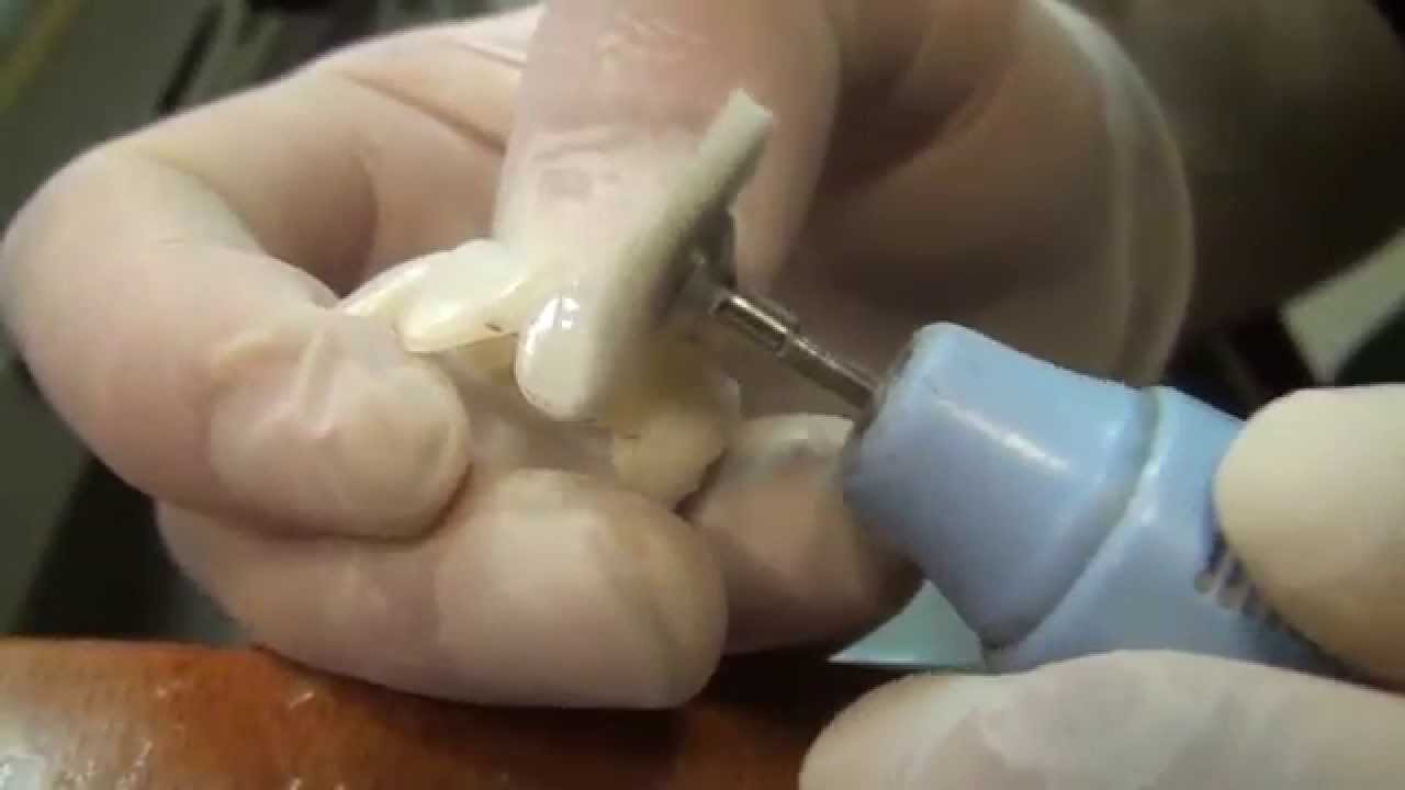 Orbel :Lucidare la Zirconia con Zirkopol, pochi passaggi e risultati strepitosi