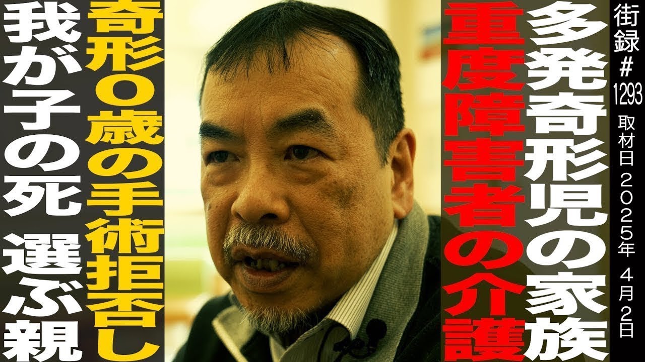 小児外科医 松永正訓/多発奇形児の家族/重度障害者の介護/奇形0歳の手術拒否し我が子の死選ぶ親