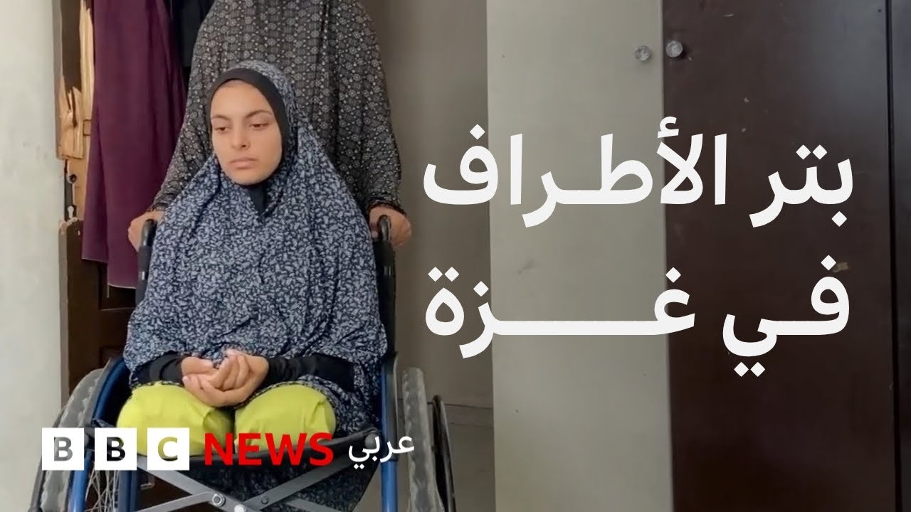 غزة: انهيار المنظومة الصحية يجبر الأطباء على عمليات البتر