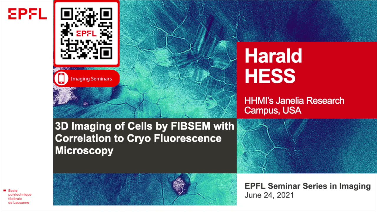 Harald Hess - 3D Imaging of Cells by FIBSEM with Correlation to Cryo Fluorescence Microscopy
