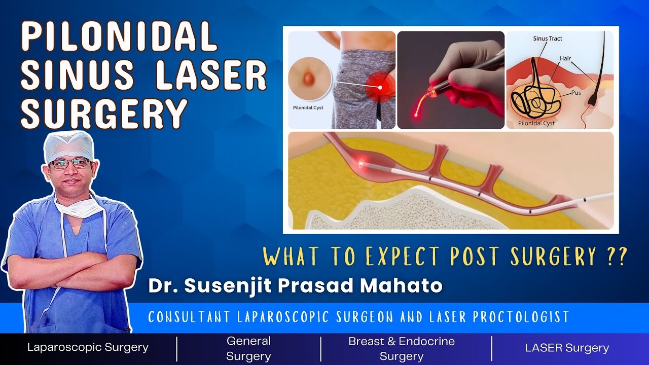 Pilonidal Sinus LASER Surgery: what to expect post surgery ??