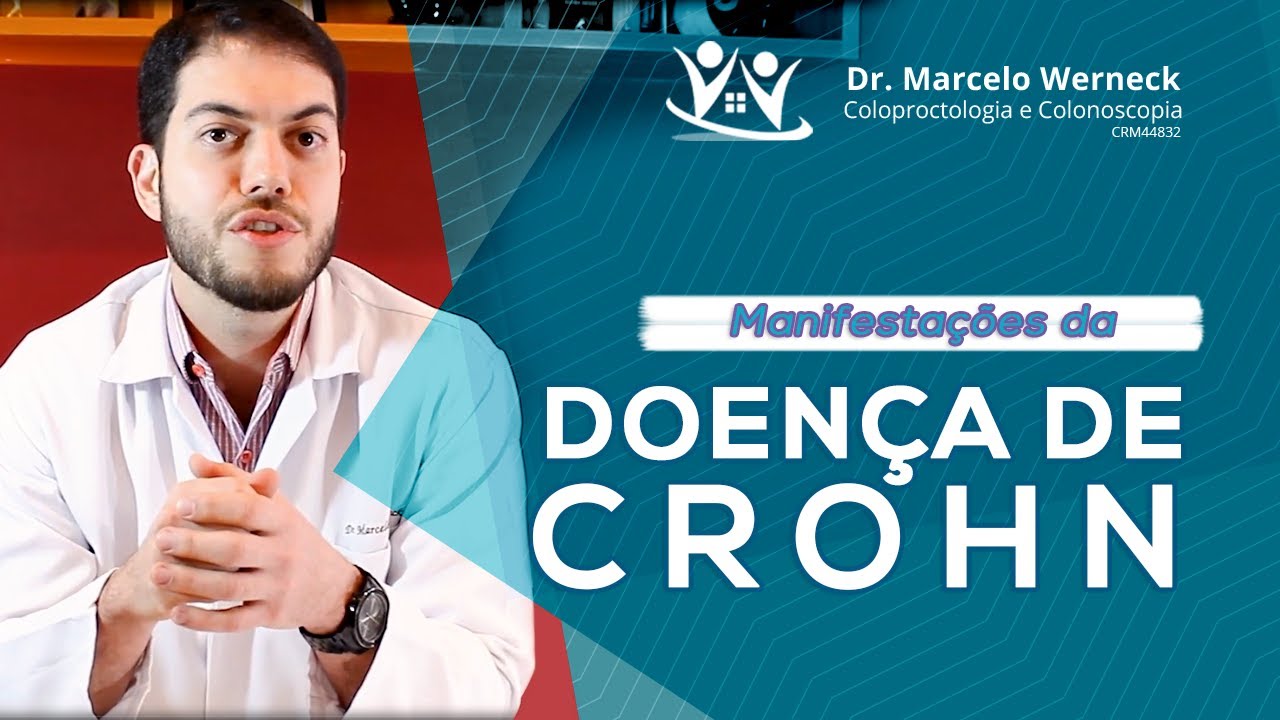 Sintomas  da doen&ccedil;a de Crohn | Dr. Marcelo Werneck