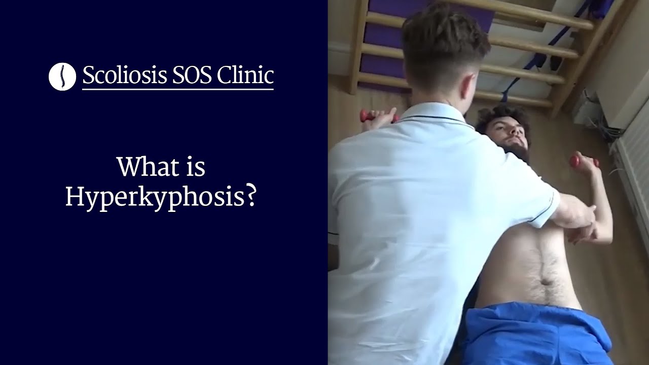 What is Hyperkyphosis? | Scheuermann's Disease & Bad Posture