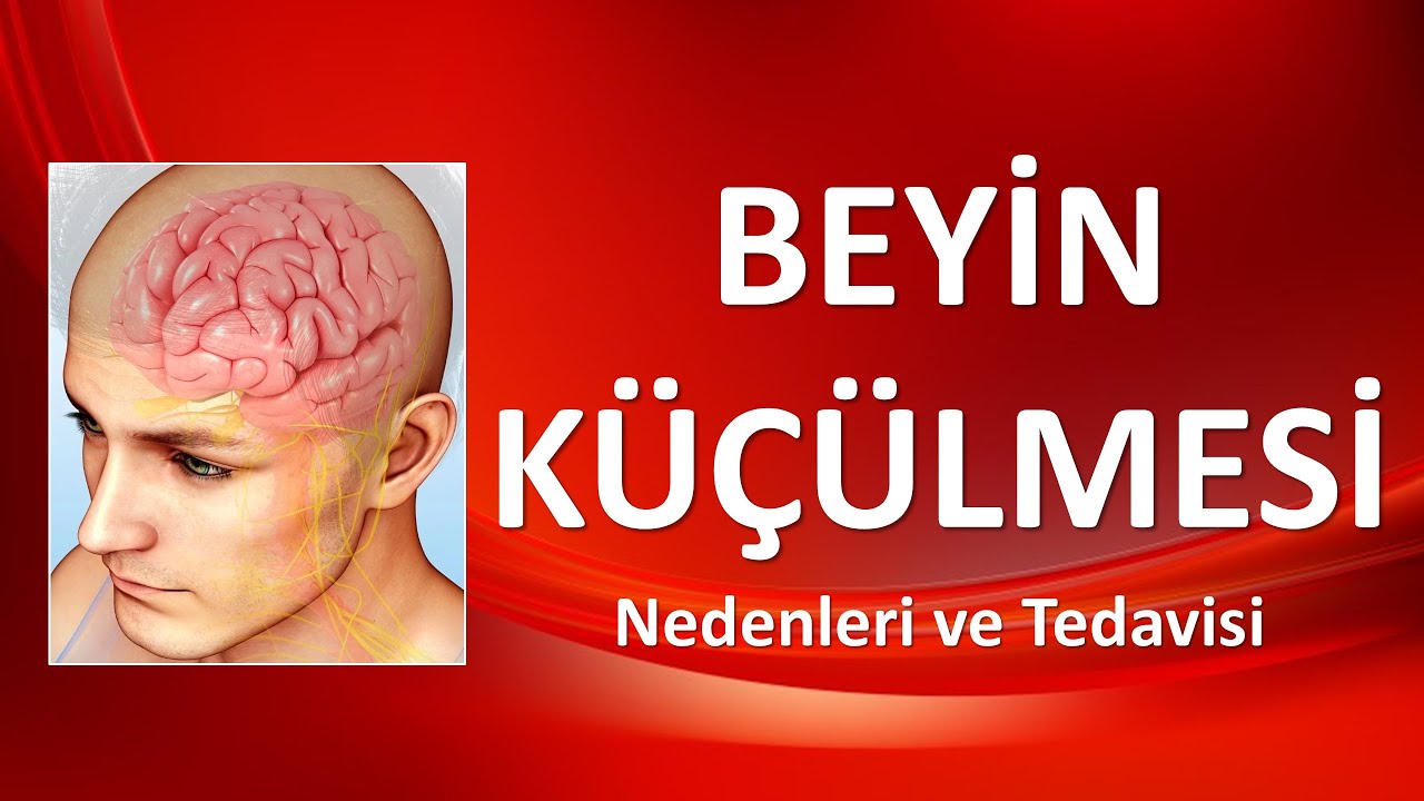 BEYİN KÜÇÜLMESİ Nedenleri ve Tedavisi
