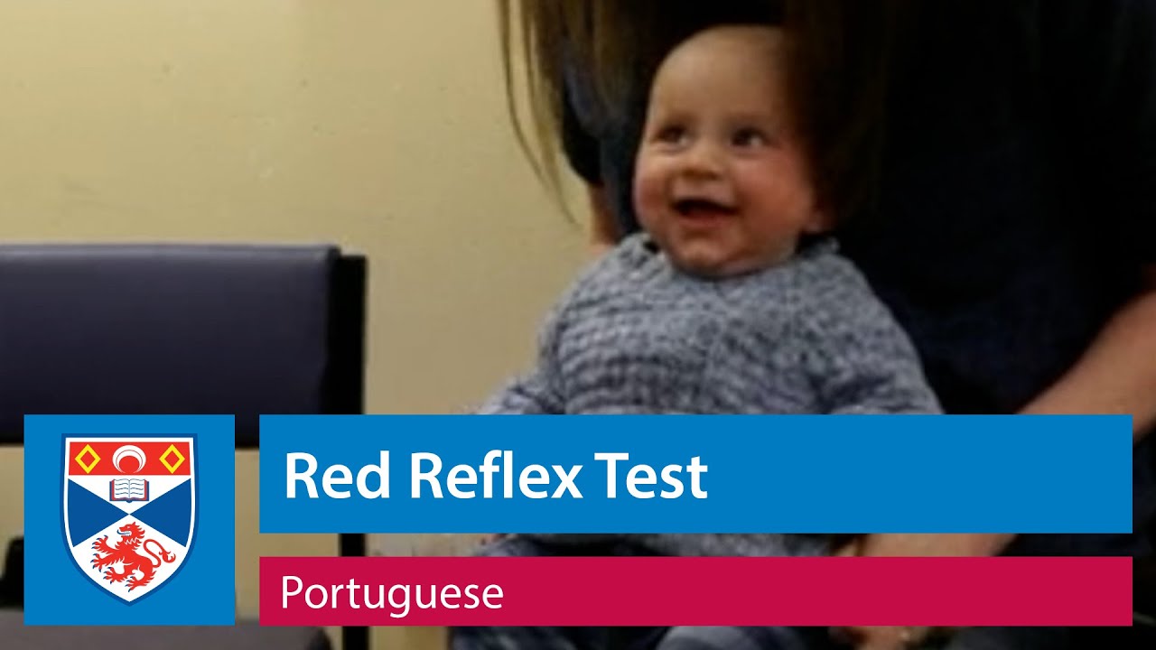 Red Reflex Test using the Arclight Low-Cost Ophthalmoscope (Portuguese)