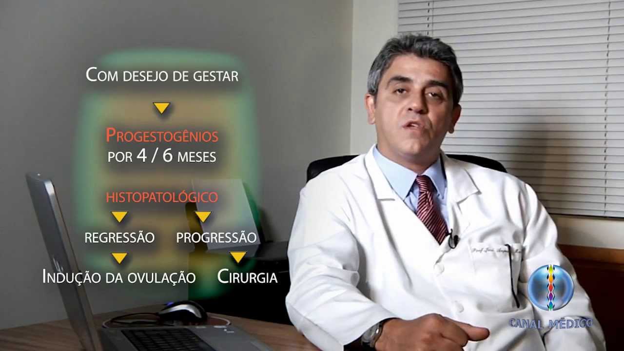 Hiperplasias do Endométrio - Tratamento 7/7