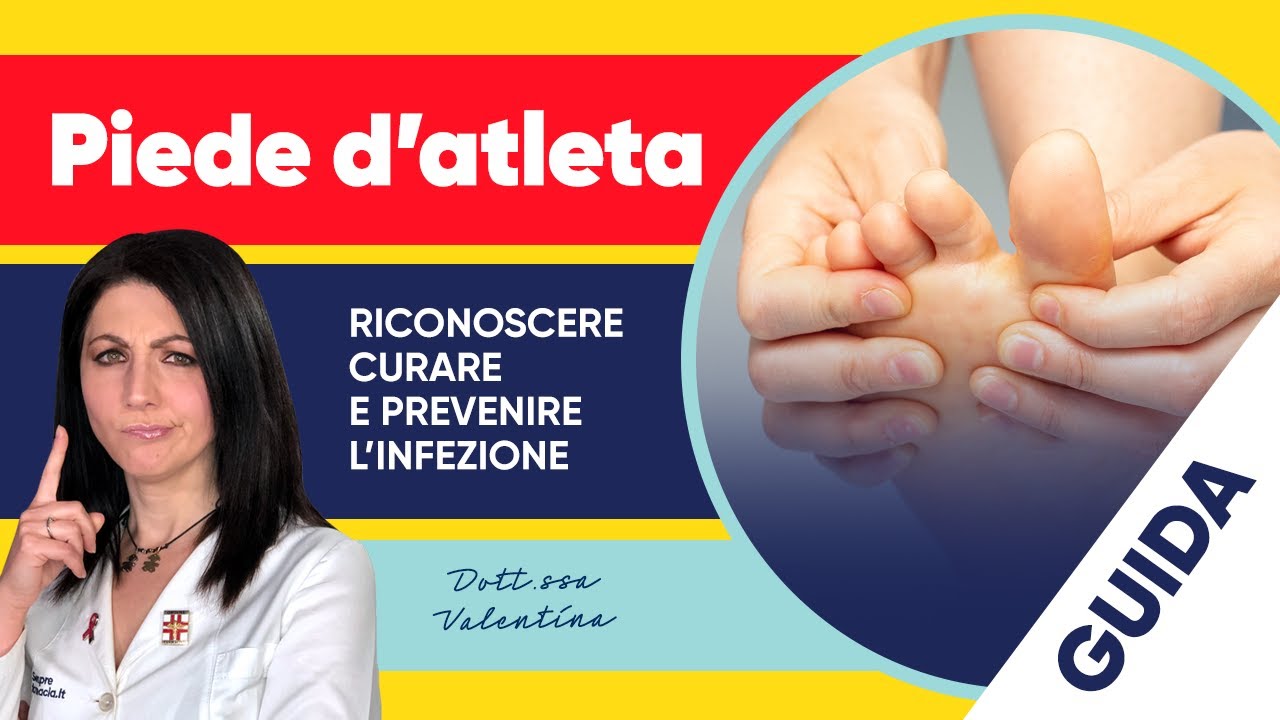 Piede d’atleta: come riconoscere, curare e prevenire l’infezione