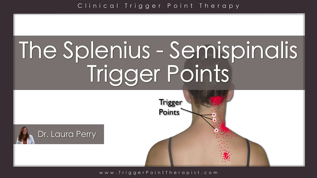 The Splenius and Semispinalis Trigger Points