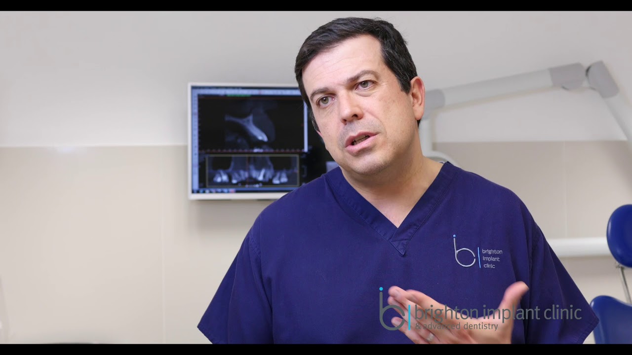 Dental Implants On The NHS ? - Brighton Implant Clinic