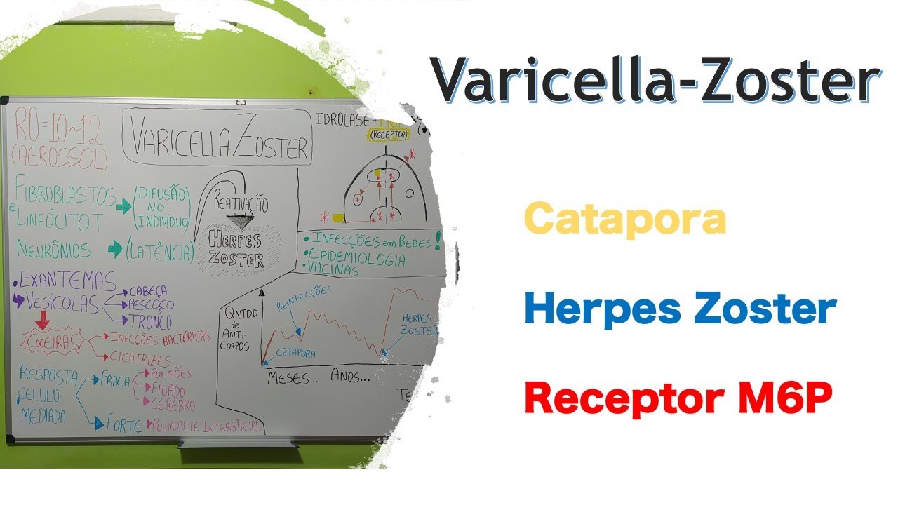 Varicella Zoster (HZV) (Catapora e Herpes Zoster) | Curso de virologia | Medicina passo a passo