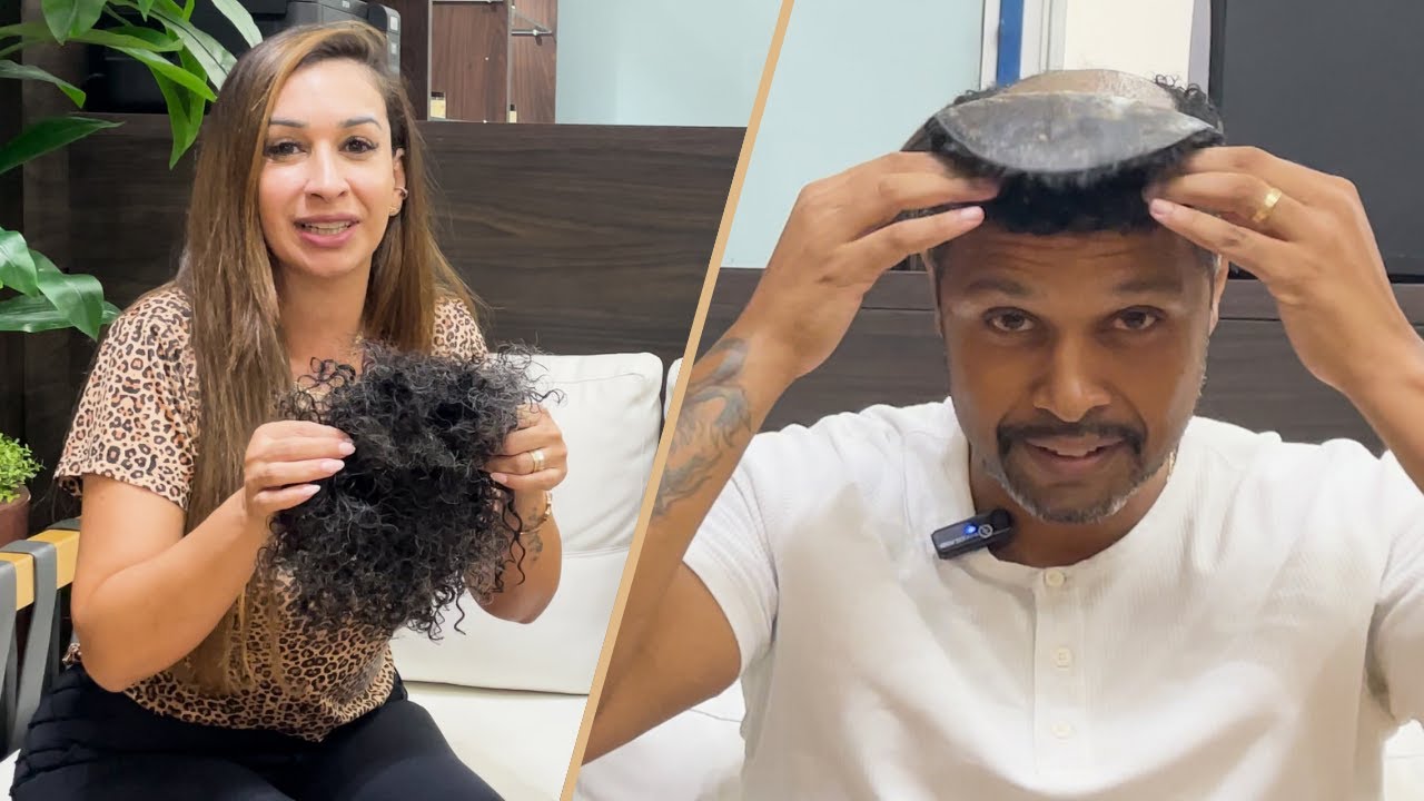 3 Anos Depois:  Experiência do meu Marido com a Longa Duração da Prótese Capilar!
