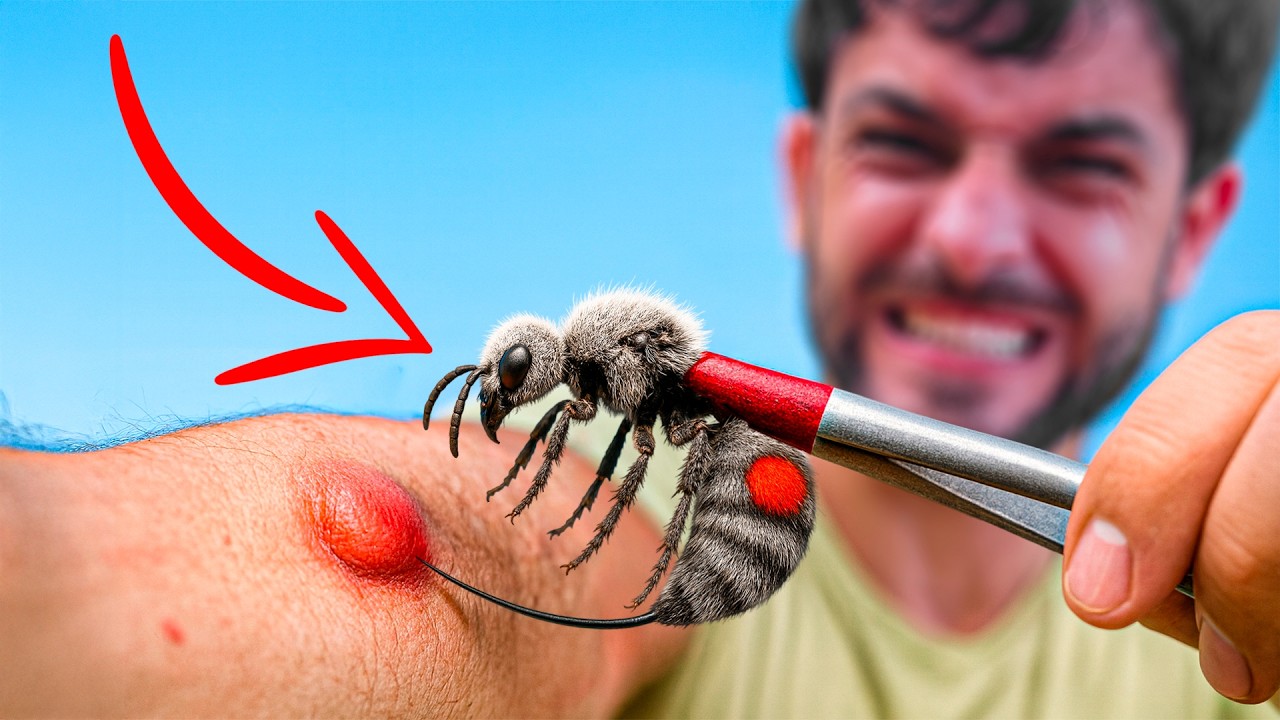 AVISPA MATA VACAS Picadura EXTREMA !!! - Peores Picaduras #10