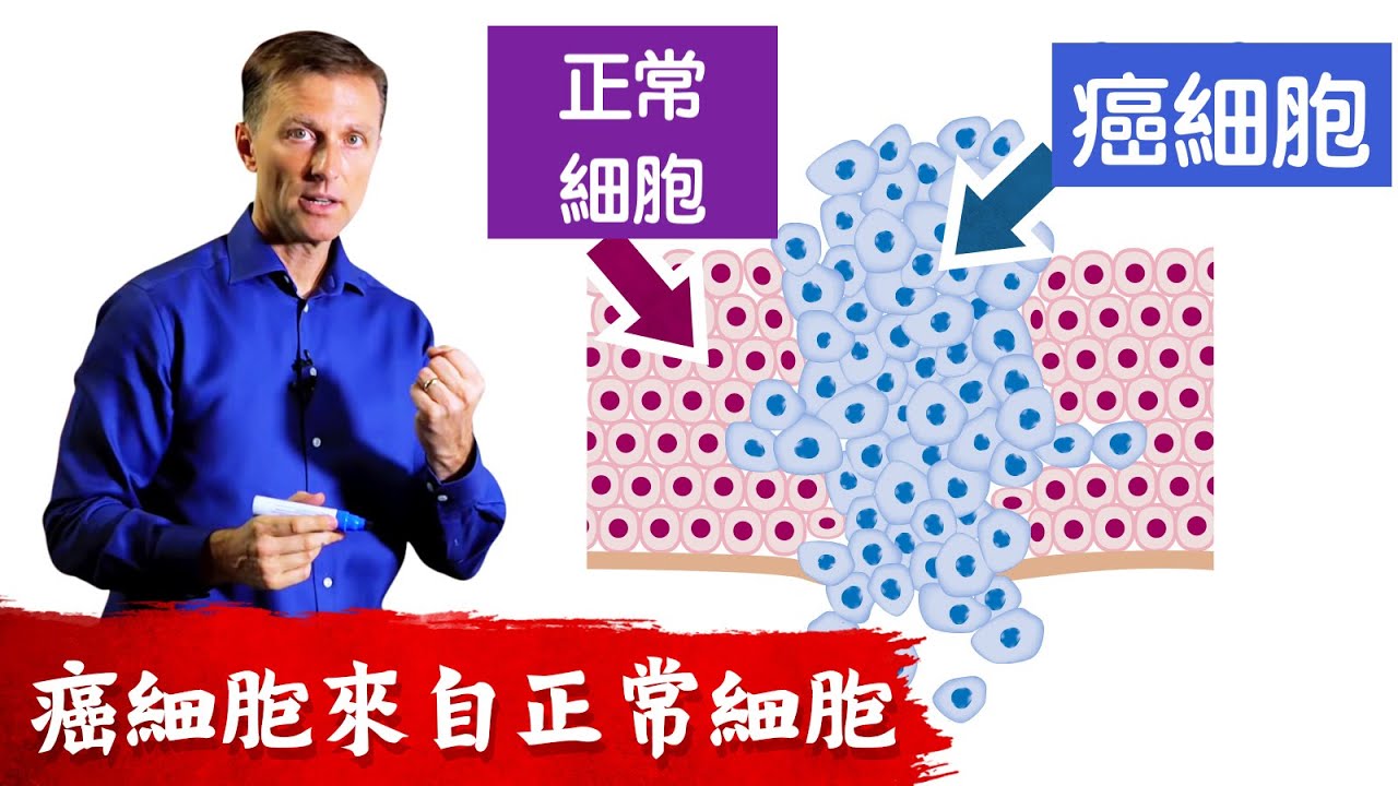 (癌7)細胞來自正常細胞?如何保護細胞?柏格醫生 Dr Berg