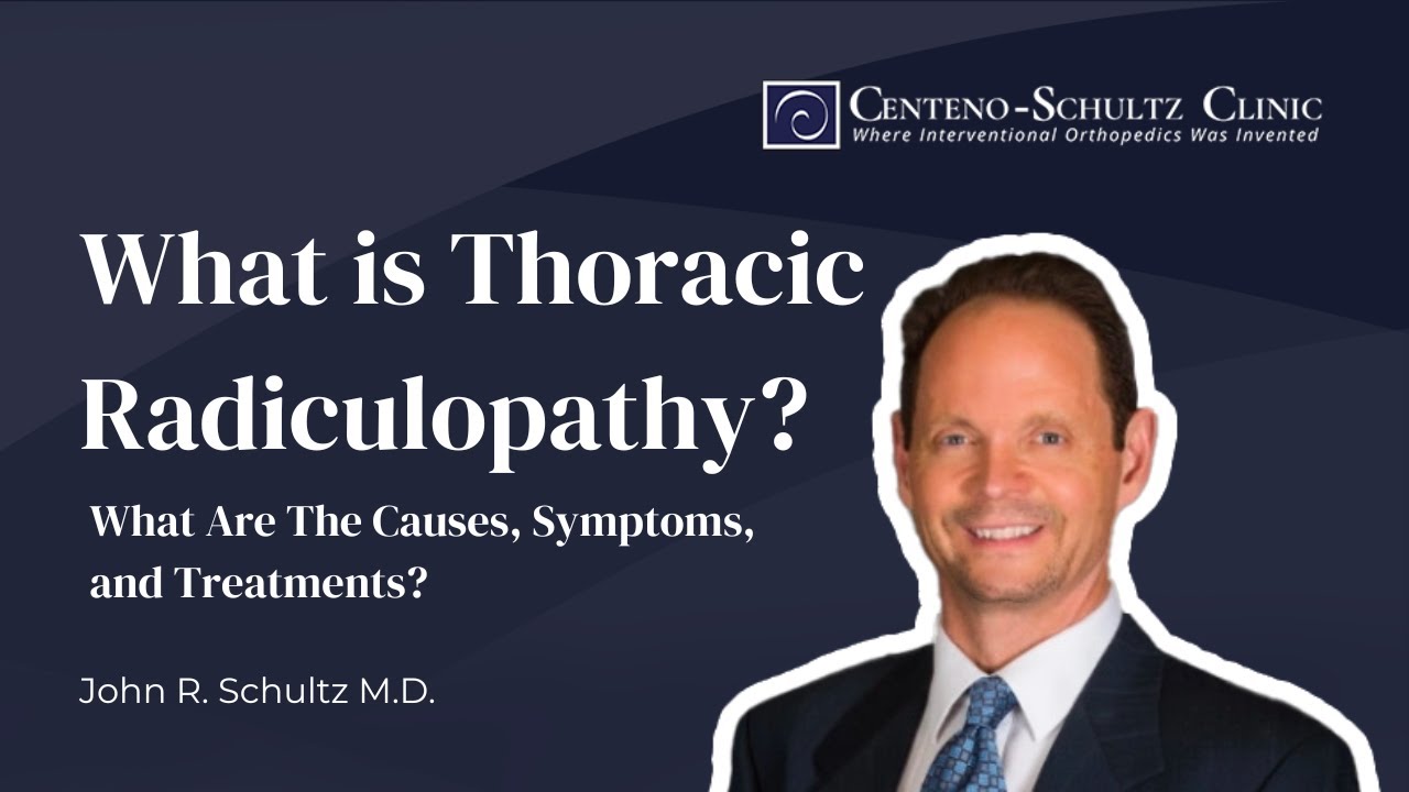 What is Thoracic Radiculopathy? What Are The Causes, Symptoms, and Treatments? (w/ Dr. John Schultz)