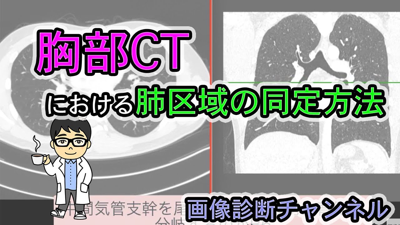 胸部CTにおける肺区域の同定方法 #概要欄に無料講座あり。