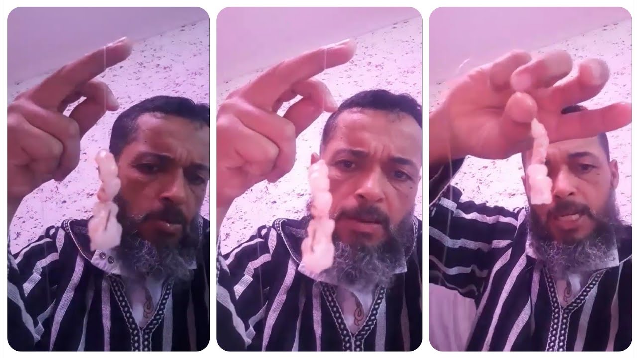 رايس فتحي / وطريقة تطعيم بالكروفيت او القمرون