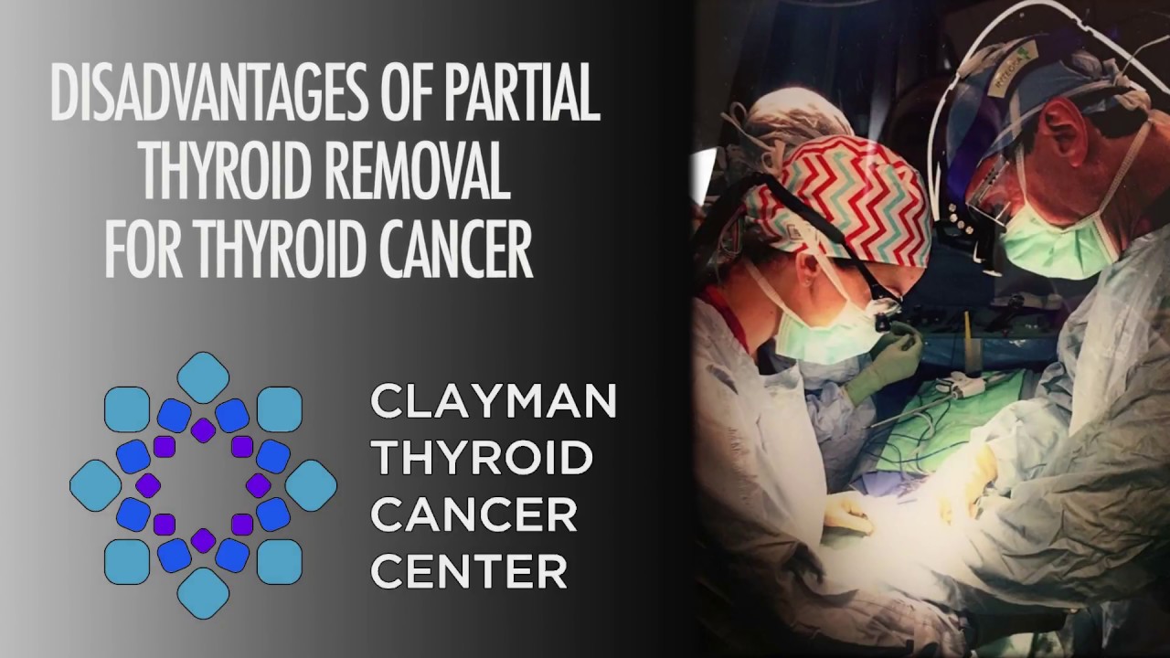 Disadvantages of Partial Thyroid Removal for Thyroid Cancer Video