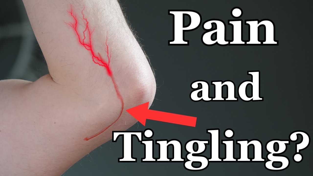 5 Tips for Treating Cubital Tunnel Syndrome