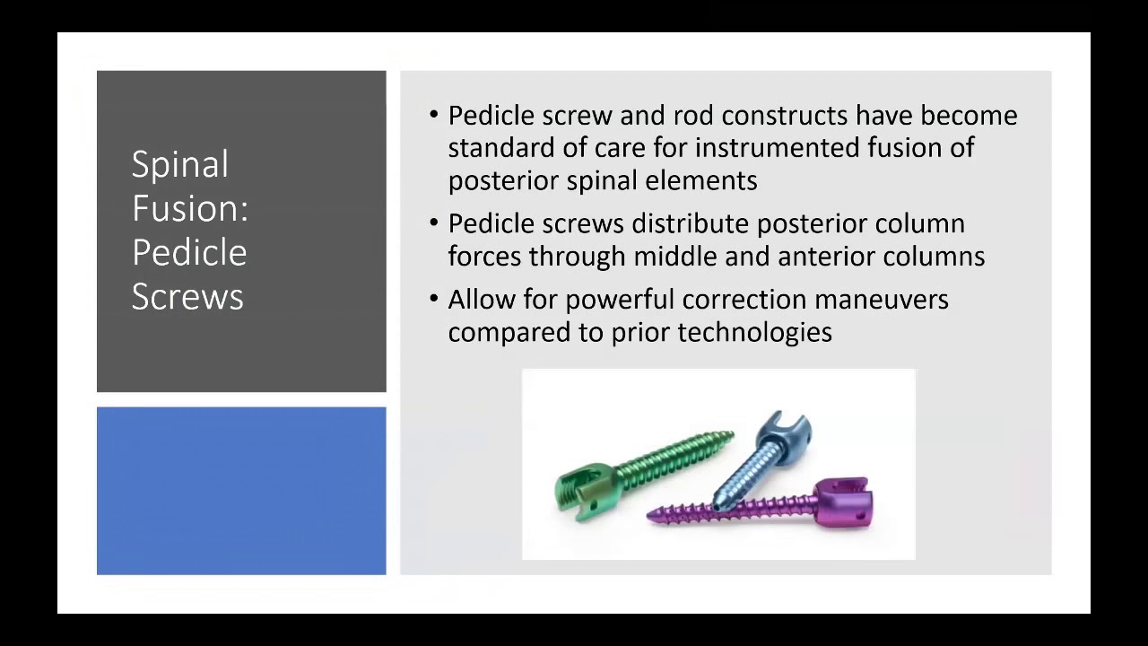 Biomechanics - Metallurgy and Implants