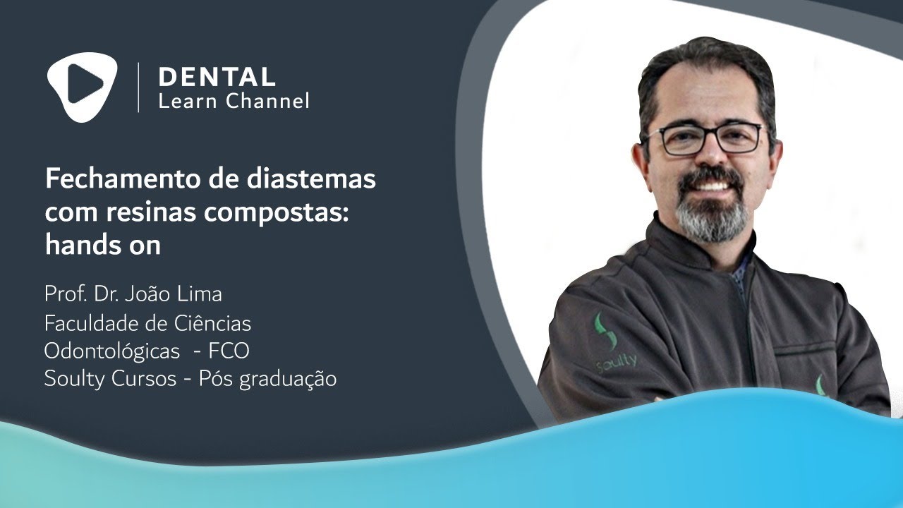 Fechamento de diastemas com resinas compostas: hands on