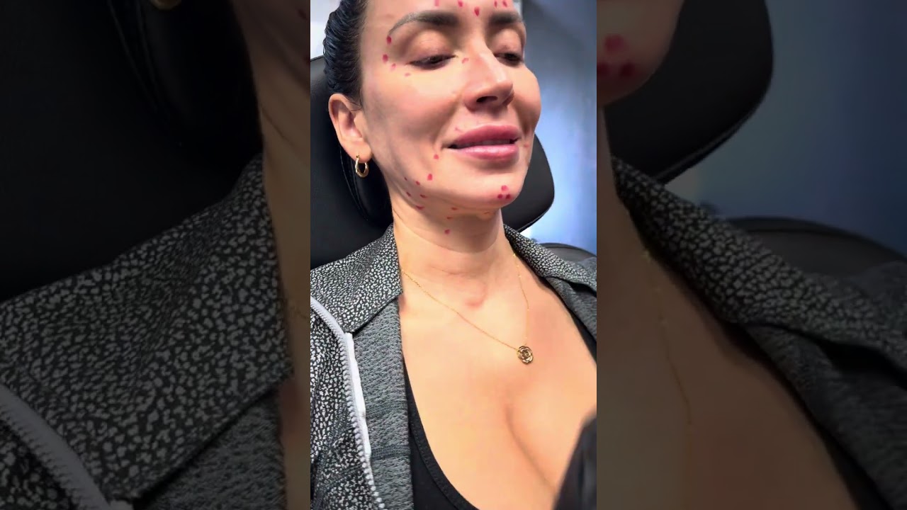 What is Botox & How To Use It