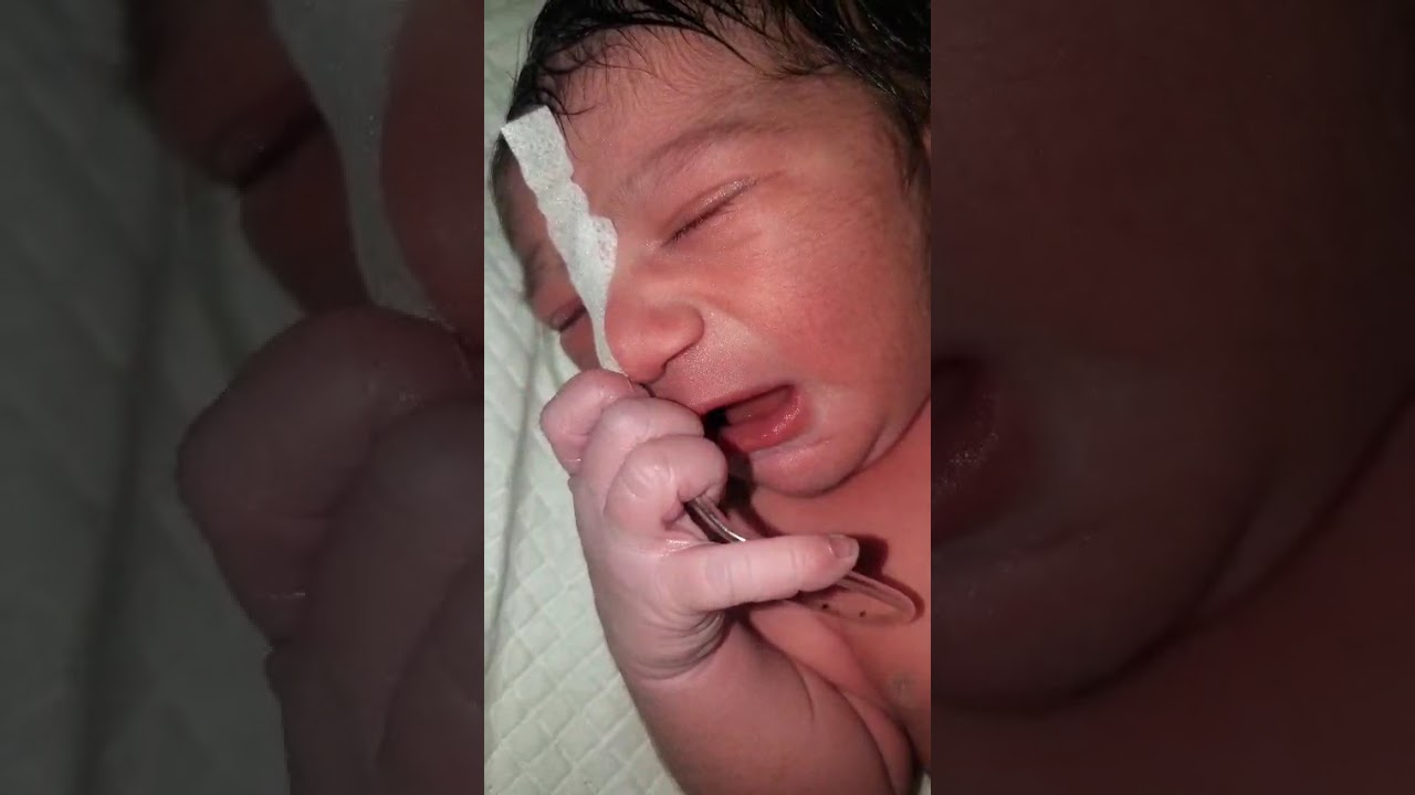 Newborn Baby Crying a Lot After Birth 😢 | Doctor Checks Baby Legs | Very Cute Face ❤️