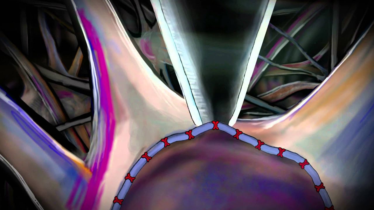 Estudio de la fisiología neuronal mediante la técnica patch