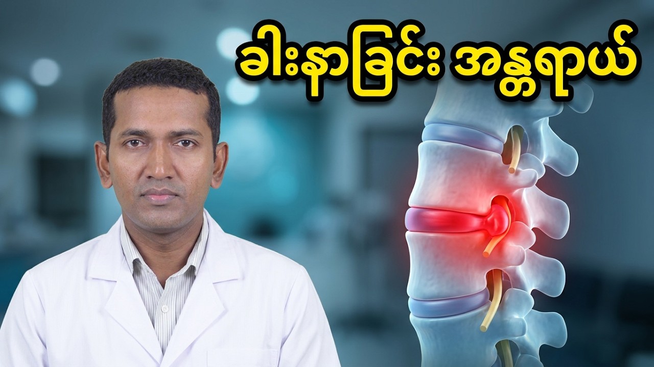 ခါးနာခြင်း (Low Back Pain)