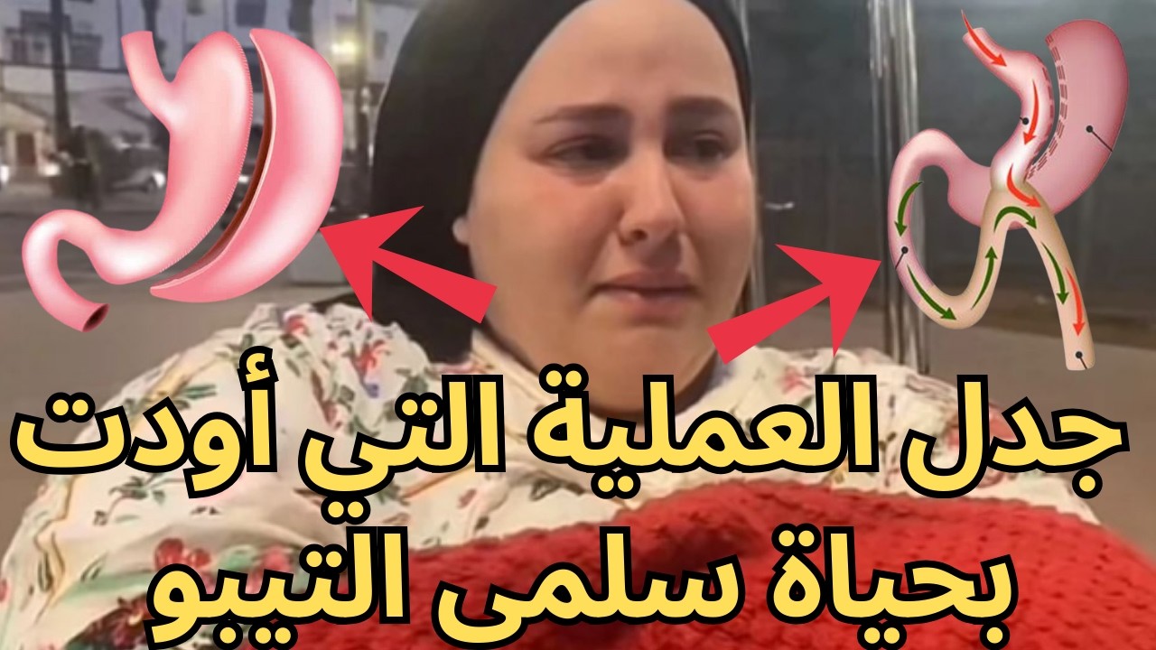 فاجعة سلمى التيبو: مؤثرة مغربية تفارق الحياة إثر مضاعفات جراحة السمنة في تركيا
