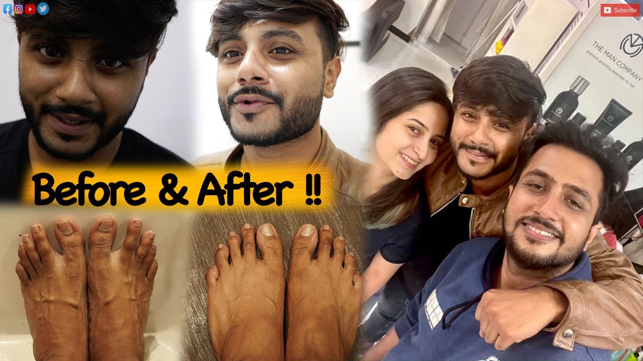Before & After !! | Sayanta Modak | The Confused Box