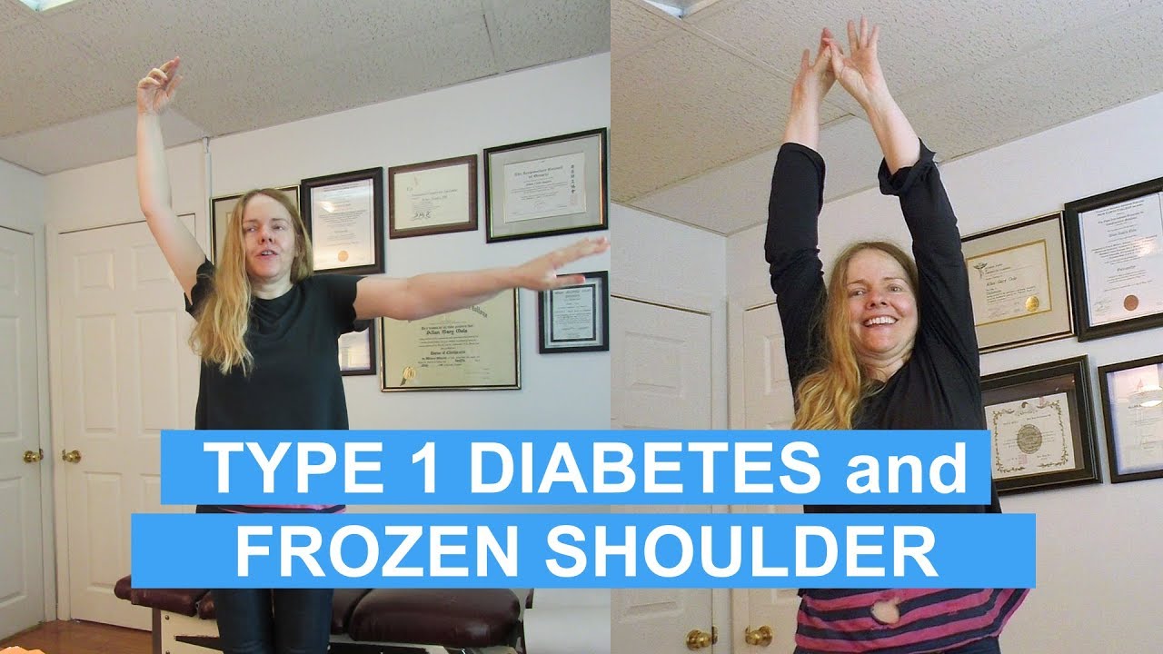 FROZEN SHOULDER and DIABETES: Trigenics OAT Procedure