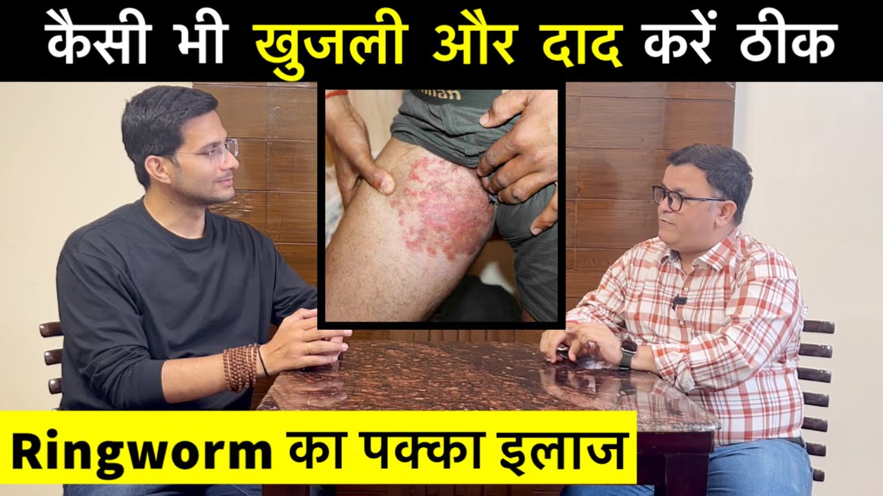 Ringworm Fungal Infection Ft. @Shree Radhey Homeopathy | Daad khaj khujli ka ilaj | Himanshu Bhatt