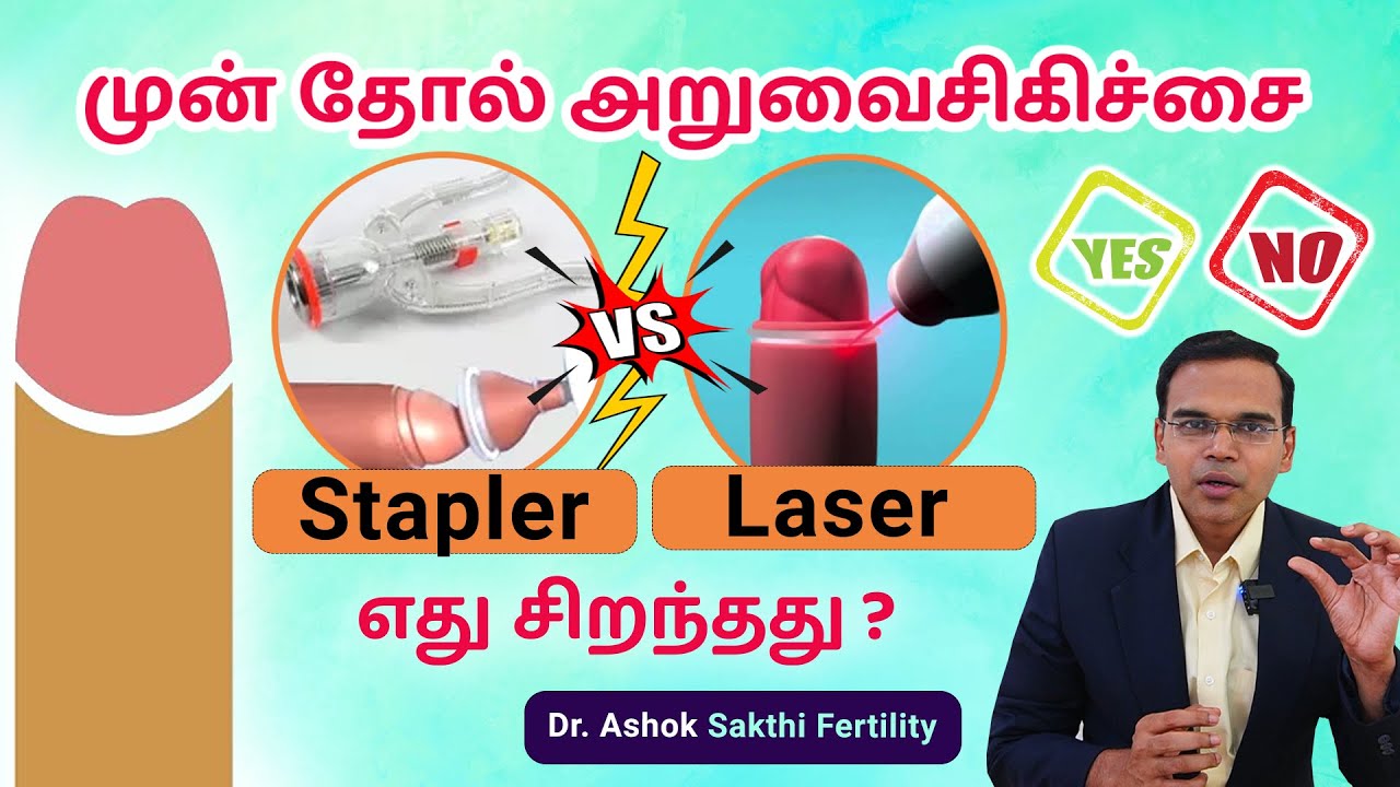 முன் தோல் அறுவைசிகிச்சை எது சிறந்தது-Which is the best surgery circumcision-Phimosis best treatment