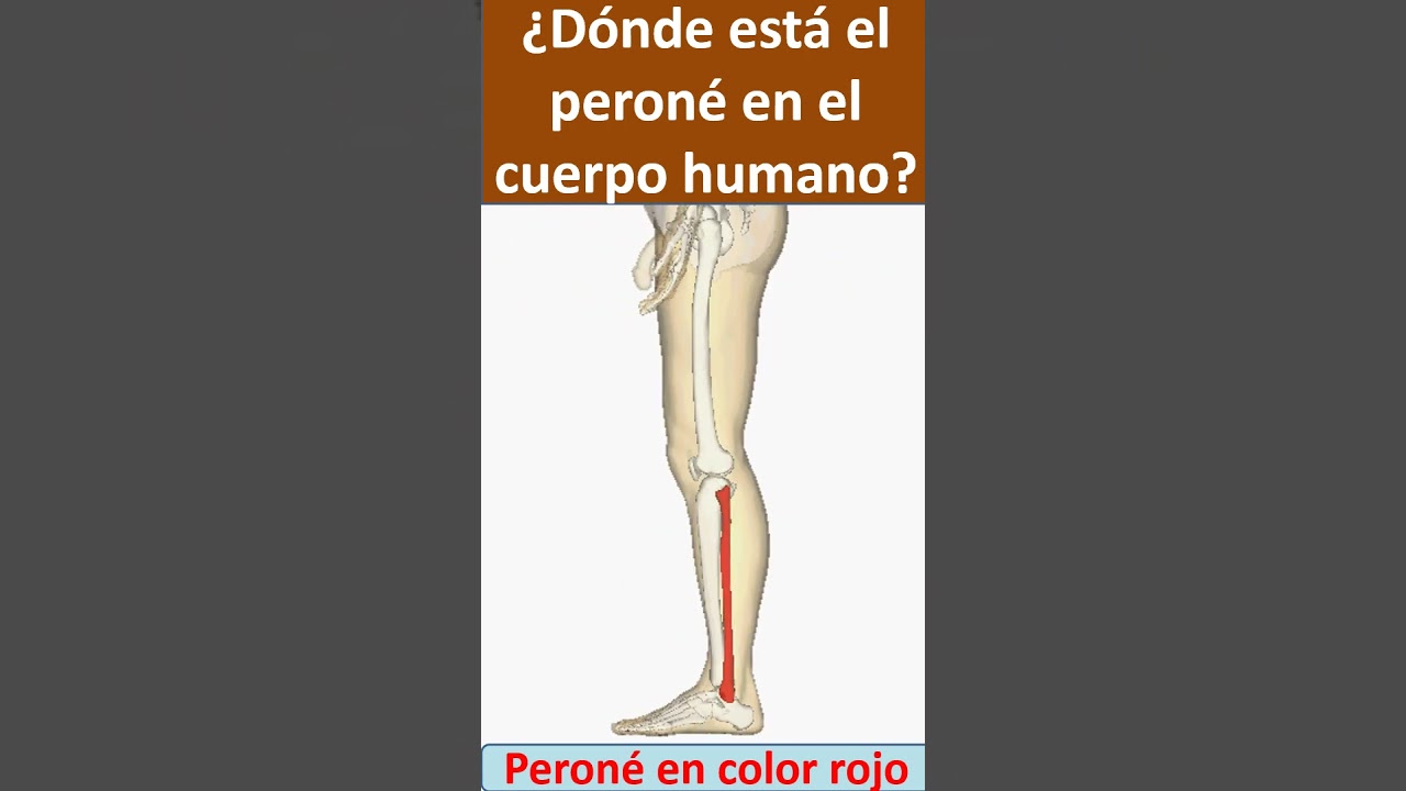 Donde esta el perone