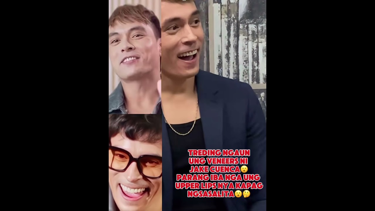 #jakecuenca &lsquo;s Veneer 😮😮😮parang din hahaha sya komportable mgsalilq si Jake🥺 #celebrity  #ccto