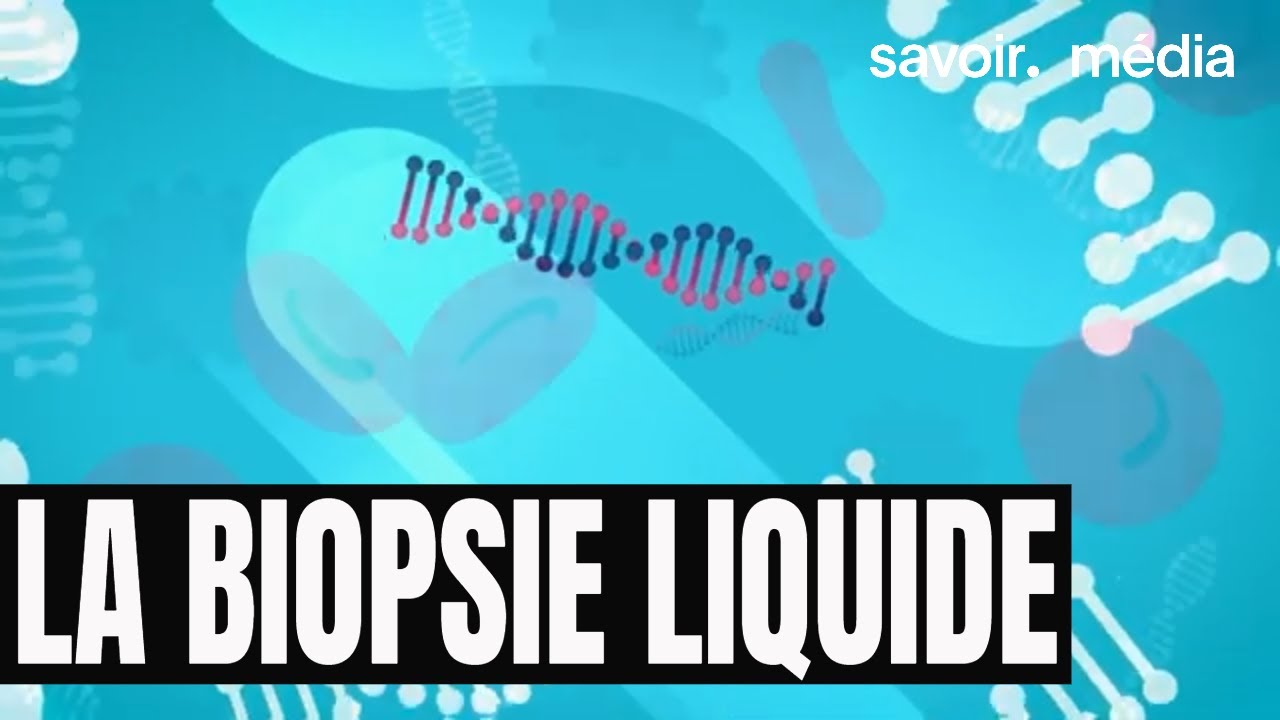 La biopsie liquide - Diagnostics de pointe