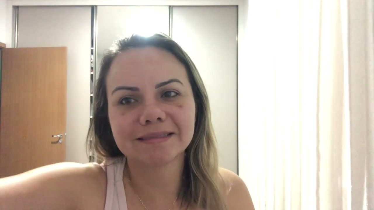 Minha rinoplastia | Como foi minha cirurgia | parte 1 | Nariz negr&oacute;ide