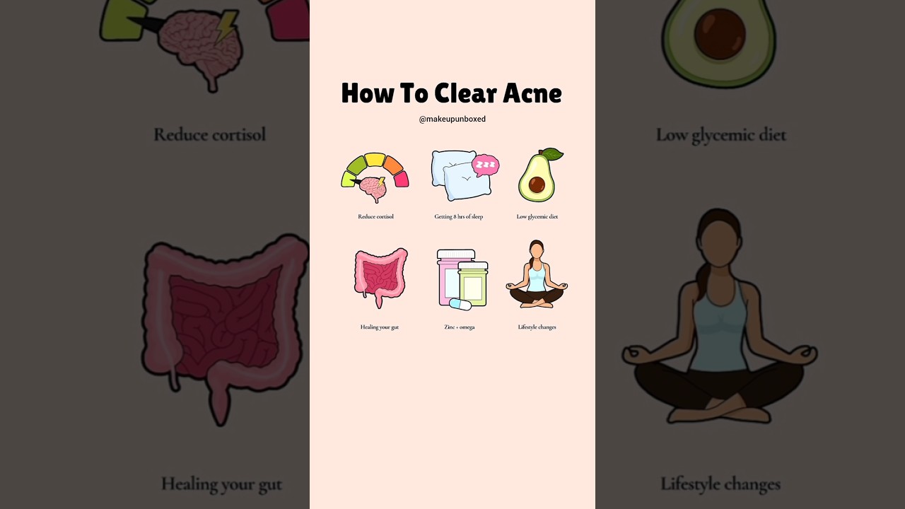 HOW TO CLEAR ACNE  #acne #clearskin #skincare