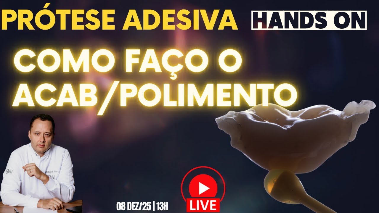 Prótese adesiva com fibra: como eu faço o acabamento e polimento?