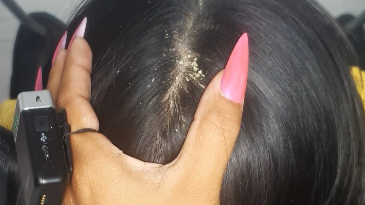 Long Hair Scalp Scratching ASMR 💤 | Dandruff Check + Beautiful Nails #008