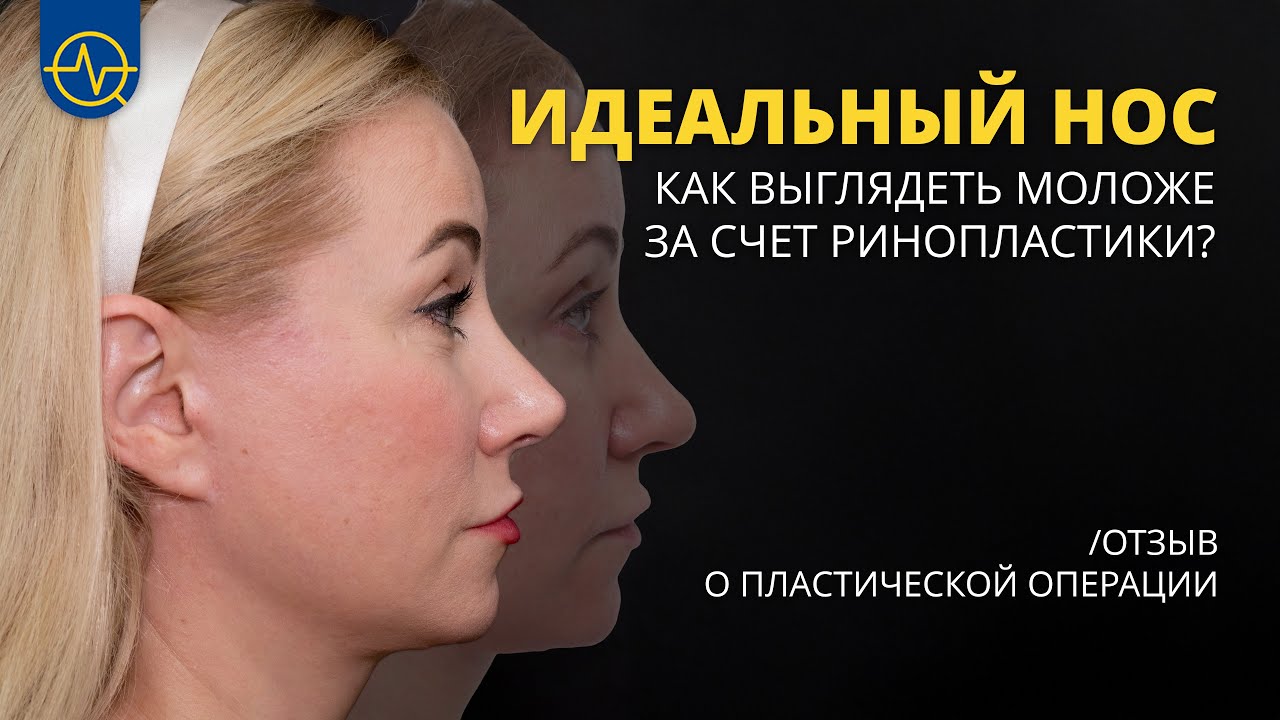 Ринопластика в Корее для европейского лица — честный отзыв