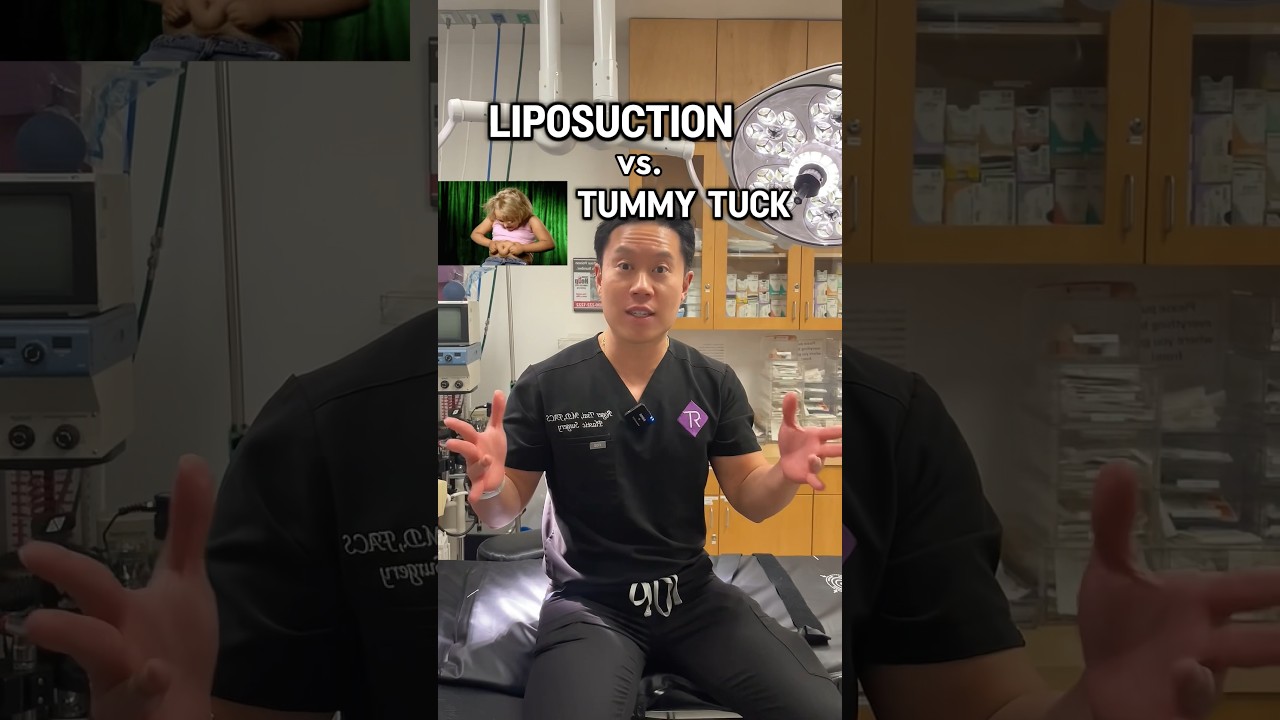 LIPOSUCTION VS TUMMY TUCK #plasticsurgeon #information #liposuction #tummytucksurgery