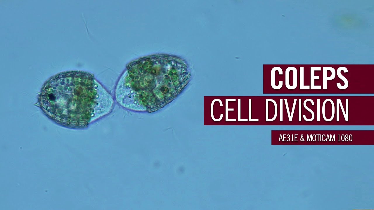 One Coleps makes two, cell division | by Motic Europe
